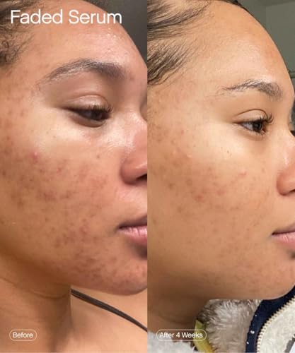 Brightening and Clearing Serum with Kojic Acid Niacinamide W68770